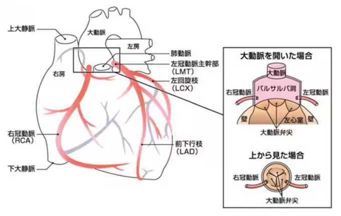 冠動脈　バルサルバ洞