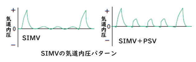 SIMVの気道内圧パターン