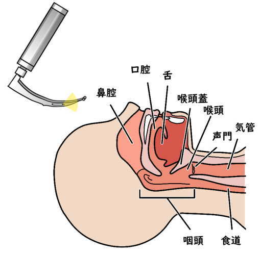 気管挿管介助　喉頭鏡