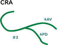 冠動脈血管造影 右冠動脈CRA