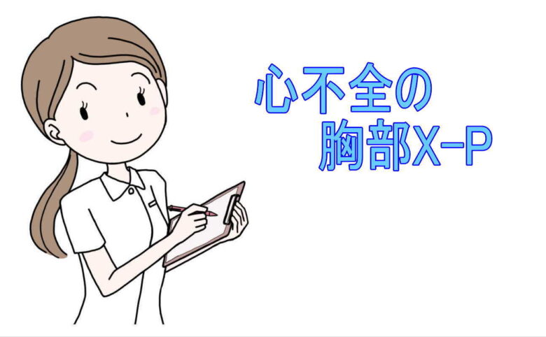 心不全の胸部X-P